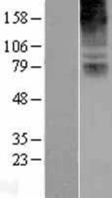 Western Blot: COL8A2 Overexpression Lysate [NBL1-09359]