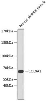 Western Blot: COL9A1 AntibodyBSA Free [NBP2-92796]