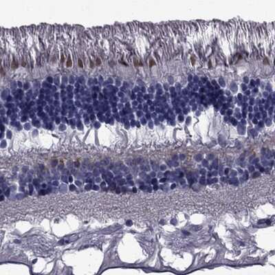 Immunohistochemistry-Paraffin: COL9A1 Antibody [NBP2-68987]