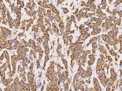 Immunohistochemistry-Paraffin: COL9A1 Antibody [NBP2-99960]