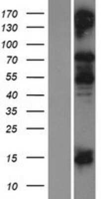 Western Blot: COL9A1 Overexpression Lysate [NBP2-05788]