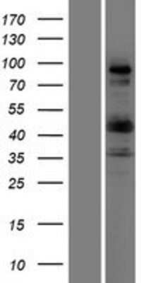 Western Blot: COL9A1 Overexpression Lysate [NBP2-08168]