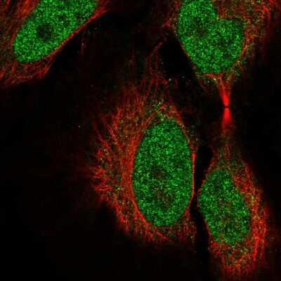 Immunocytochemistry/ Immunofluorescence: COL9A3 Antibody [NBP2-58158]