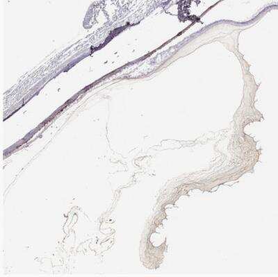 Immunohistochemistry-Paraffin: COL9A3 Antibody [NBP1-85161]