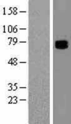 Western Blot: COL9A3 Overexpression Lysate [NBL1-09360]