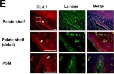 Immunohistochemistry: COLEC10 Antibody (4C1) [H00010584-M01]