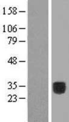 Western Blot: COLEC10 Overexpression Lysate [NBP2-07620]