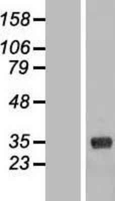 Western Blot: CL-K1/COLEC11 Overexpression Lysate [NBL1-09361]