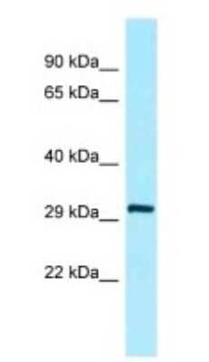 Western Blot: COLEC5 Antibody [NBP1-98277]