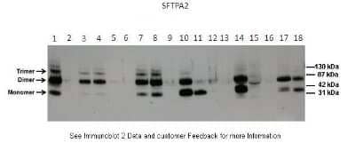 Western Blot: COLEC5 Antibody [NBP1-98277]