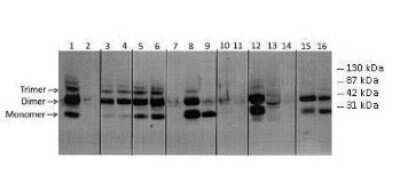 Western Blot: COLEC5 Antibody [NBP1-98277]