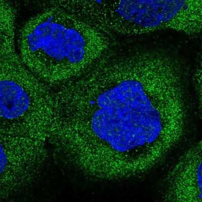 Immunocytochemistry/ Immunofluorescence: COLQ Antibody [NBP2-58409]