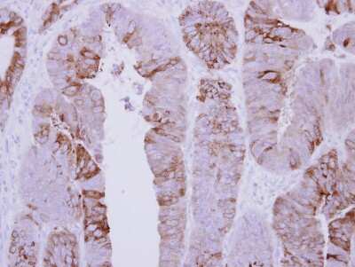 Immunohistochemistry-Paraffin: COLQ Antibody [NBP2-14915]