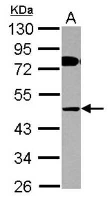 Western Blot: COLQ Antibody [NBP2-14915]