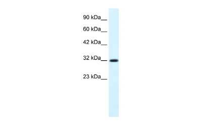 Western Blot: COLQ Antibody [NBP2-84712]