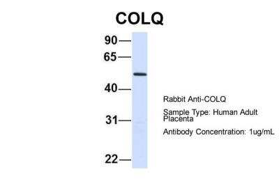 Western Blot: COLQ Antibody [NBP2-84712]