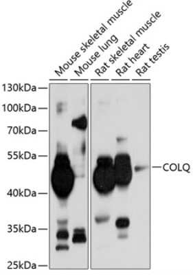 Western Blot: COLQ AntibodyBSA Free [NBP2-92021]