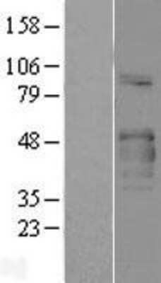 Western Blot: COLQ Overexpression Lysate [NBP2-04296]