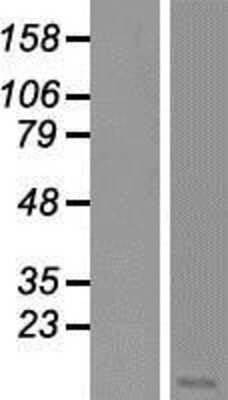 Western Blot: COM1/p8 Overexpression Lysate [NBP2-07458]