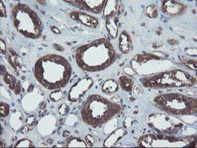Immunohistochemistry-Paraffin: COMMD1 Antibody (OTI1F2) [NBP2-03755]