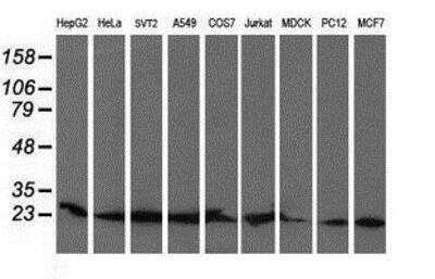 Western Blot: COMMD1 Antibody (OTI1F2) [NBP2-03755]