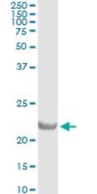 Immunoprecipitation: COMMD1 Antibody (2A12) [H00150684-M01]