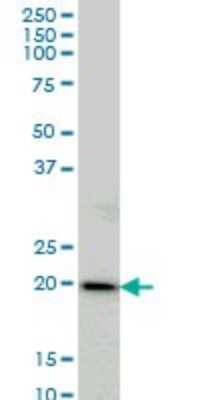 Western Blot: COMMD1 Antibody (2A12) [H00150684-M01]