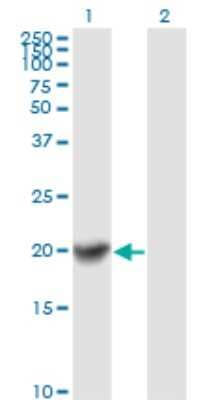 Western Blot: COMMD1 Antibody (2A12) [H00150684-M01]
