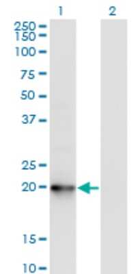 Western Blot: COMMD1 Antibody (2B12) [H00150684-M03]