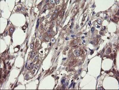 Immunohistochemistry: COMMD1 Antibody (OTI2E2) [NBP2-46331]