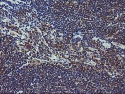 Immunohistochemistry: COMMD1 Antibody (OTI2E2) [NBP2-46331]