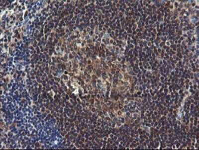 Immunohistochemistry: COMMD1 Antibody (OTI2E2) [NBP2-46331]