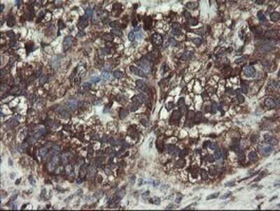 Immunohistochemistry: COMMD1 Antibody (OTI2E2) [NBP2-46331]