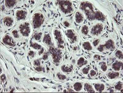 Immunohistochemistry: COMMD1 Antibody (OTI2E2) [NBP2-46331]