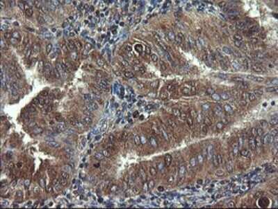 Immunohistochemistry: COMMD1 Antibody (OTI2E2) [NBP2-46331]