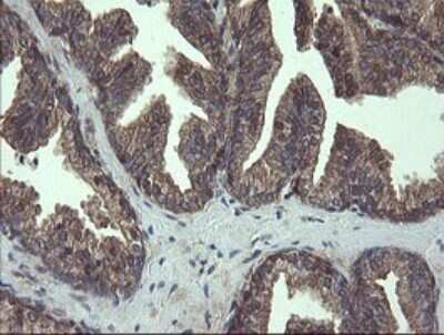 Immunohistochemistry: COMMD1 Antibody (OTI2E2) [NBP2-46331]