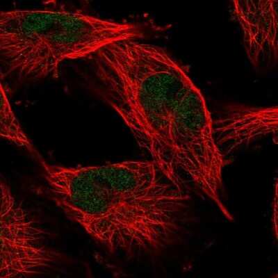 Immunocytochemistry/ Immunofluorescence: COMMD1 Antibody [NBP2-55468]