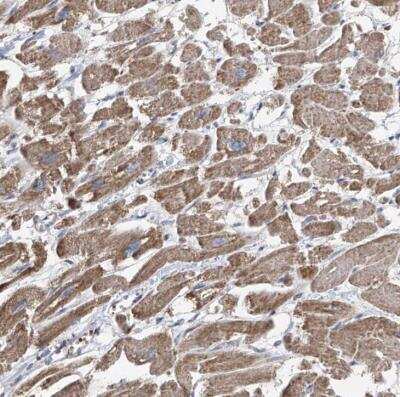 Immunohistochemistry-Paraffin: COMMD1 Antibody [NBP1-86797]