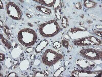 Immunohistochemistry: COMMD1 Antibody (OTI1F2) - Azide and BSA Free [NBP2-72419]