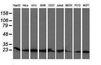 Western Blot: COMMD1 Antibody (OTI1F2)Azide and BSA Free [NBP2-72419]