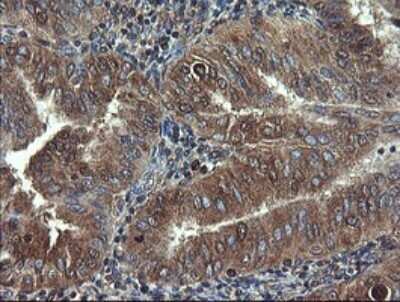 Immunohistochemistry: COMMD1 Antibody (OTI2E2) - Azide and BSA Free [NBP2-72418]