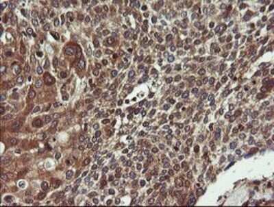Immunohistochemistry: COMMD1 Antibody (OTI2E2) - Azide and BSA Free [NBP2-72418]