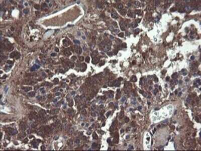 Immunohistochemistry: COMMD1 Antibody (OTI2E2) - Azide and BSA Free [NBP2-72418]
