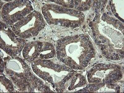 Immunohistochemistry: COMMD1 Antibody (OTI2E2) - Azide and BSA Free [NBP2-72418]
