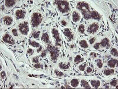 Immunohistochemistry: COMMD1 Antibody (OTI2E2) - Azide and BSA Free [NBP2-72418]