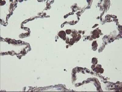 Immunohistochemistry: COMMD1 Antibody (OTI2E2) - Azide and BSA Free [NBP2-72418]