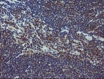 Immunohistochemistry: COMMD1 Antibody (OTI2E2) - Azide and BSA Free [NBP2-72418]
