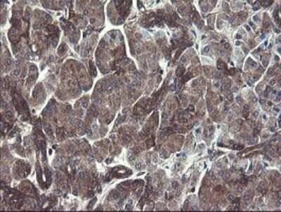 Immunohistochemistry: COMMD1 Antibody (OTI2E2) - Azide and BSA Free [NBP2-72418]
