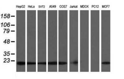 Western Blot: COMMD1 Antibody (OTI2E2)Azide and BSA Free [NBP2-72418]