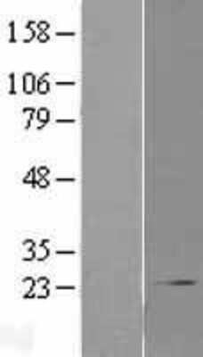 Western Blot: COMMD1 Overexpression Lysate [NBL1-09365]